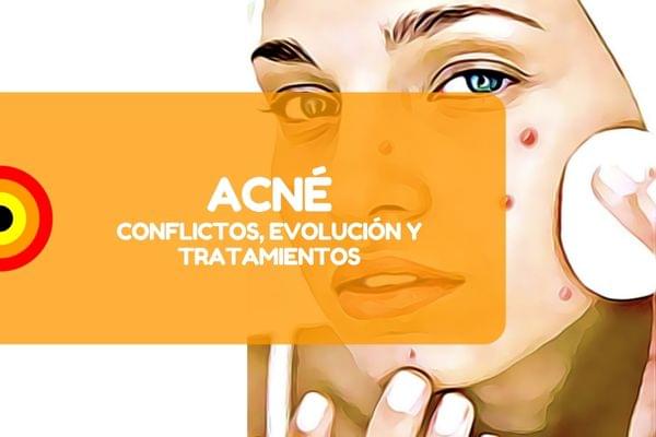 ACNE nueva medicina NMG